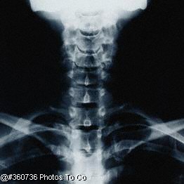 X-ray image